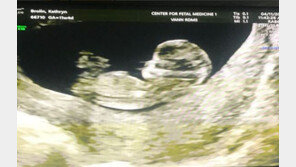 ‘어벤저스3’  절대 악당 조슈 브롤린, ‘20세 연하’ 아내 태아 사진 공개