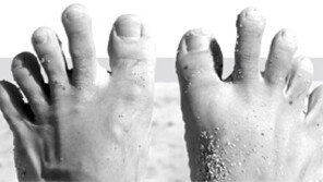 “독한 무좀균, 3주 이상 연고 발라야 완전히 사라져요”