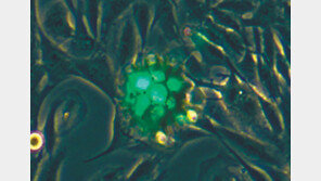초소형 로봇 몸속 주입… 세포 원하는 곳 보낸다