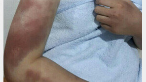 ‘관악산 집단폭행’ 피해자 언니 “산에서 옷 다 벗기고 성추행…조건만남 시키려 해”