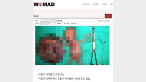 워마드 이번에는 ‘낙태인증’ 놀이…태아 훼손 사진에 충격적 댓글