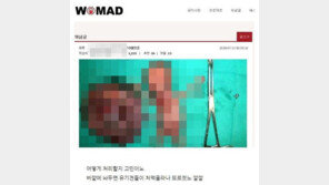 워마드, 태아 훼손 사진에 온라인 ‘발칵’…경찰 “서버 외국에, 폐쇄 어려워” 
