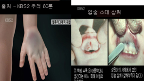 ‘울산 성민이 사건’ 靑 국민청원 참여자 30만명 육박…“다시는 이런 일 없길”