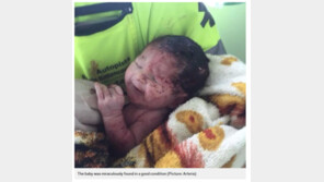 교통사고 충격 →산모 배 속 아기, 세상 밖으로…기적적 생존