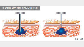 약물 피부에 붙이고, 초고속 분사… 주삿바늘 공포서 해방된다
