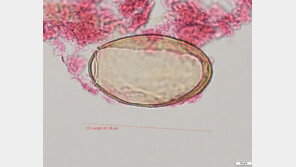 [단독]국내 최초 조선시대 미라서 폐흡충 발견…조선왕들 사망원인 밝혀질까? 
