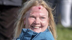 날아온 골프공에 이마를 다친 여성, 그럼에도 웃다