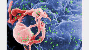 에이즈 감염된 모친의 간, 생명 위독한 아기에 이식…세계 최초