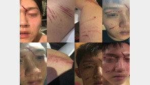 구하라 前남친 측, 상처투성 얼굴 공개 속 “동영상 협박無”