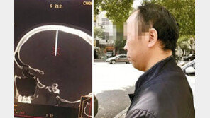 두통 심해 병원 갔더니…머리에 못이 박혀 있어