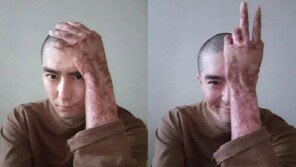 이찬호 예비역 병장 “자살 생각했지만…전신화상에 움직일 수조차 없어 포기”