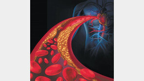 심혈관질환 부르는 ‘이상지질혈증’… “국가적 대책 필요”