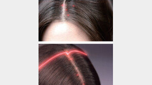 [brand&]탈모가 시작되기 전 두피와 모발이 보내는 위험 신호를 놓치지 마세요!