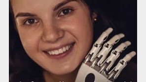 도끼로 아내 두 손 자른 남편…17만원 벌금?