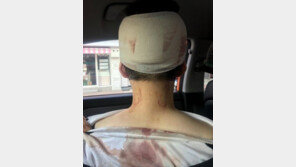 ‘이수역 주점 폭행’ 커플 여성 추정 글, 본인 작성 아냐…타인이 사칭