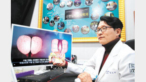 비대해진 전립선, 수술 아닌 ‘시술’로 해결