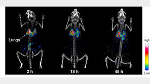 몸 속 미세먼지 한 톨까지 잡아내는 분자영상 기술 개발