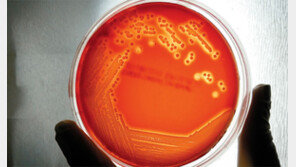 슈퍼박테리아, 정면대결 대신 힘빼서 잡는다 