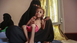 유엔 “예멘서 매주 123명 민간인이 전투로 죽거나 크게 다쳐”