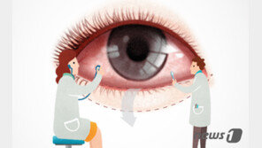 젊어지려 ‘하안검’ 수술…눈꺼풀 뒤집혀 고민하는 중년들