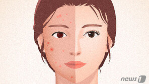 예뻐지려 속눈썹 연장하고 파마…눈 건강에 ‘독’