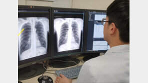 서울대병원 “AI로 폐암 조기 진단한다”…판독 정확도 97% 수준