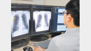 서울대병원, 환자 영상 판독 보조에 ‘인공지능’ 활용