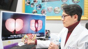 참을 수 없는 소변 마려움… 전립샘 묶어 고민 해결