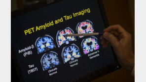 日, 약물로 기억력 회복실험 성공…치매 치료길 열리나