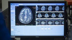 美 연구진 “숙면시간 감소는 알츠하이머 초기 증세” 