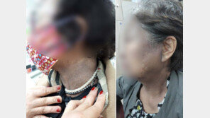 “100% 천연 믿었는데 얼굴이 새까맣게”…헤나방 피해자 속출