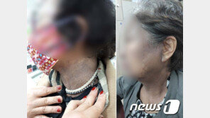 ‘헤나방 피해’ 확산에 정부 부처 합동점검…복지부 현장 단속