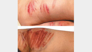 온몸 피멍 들도록… 태권도 코치가 여중생 폭행