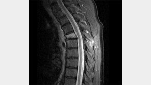 日-中 줄기세포 치료제 임상시험 속속… 한국은 규제에 발목