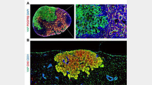 ‘지방산이 암세포 림프절 전이 핵심 연료’…IBS 세계 첫 규명