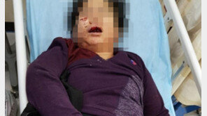  “술 취해 기억 안 나”…女 택시기사 마구 폭행 승객 자수 불구 구속 검토