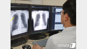 7월부터 ‘폐암’ 국가검진…50~70대 흡연자 2년마다 실시