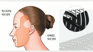 ‘탄력밴드’로 턱라인 살리고, ‘상안검 수술’로 눈밑 주름 해결