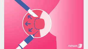 “가슴 쓰리고 부끄러워”…‘함몰유두’로 병원 찾는 2030