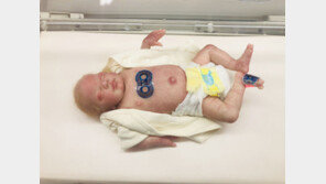 조기출산 신생아 생체정보, 무선으로 모니터링한다