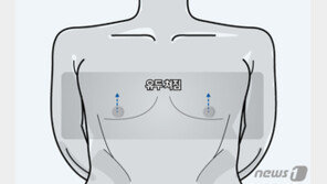 “‘저쪼아래’라고 놀리는 친구들 때문에…” 처진 유두로 병원 찾는 3040