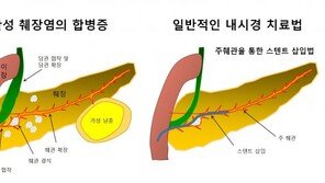 음주-흡연에 기름진 음식… 만성췌장염 부른다
