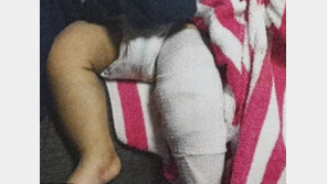 “왜 울어?”…대만서 생후 4개월 팔다리 부러뜨린 아빠