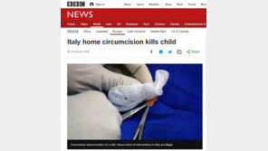 집에서 포경수술 받던 5개월 아기 사망…‘돈 아끼려다’