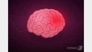 폐·소화기암 환자, 뇌졸중 사망위험 21% 높아…항암요법 후유증