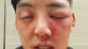 경찰 “‘양호석 차오름 폭행’ 신고 접수…양측 소환조사 계획”