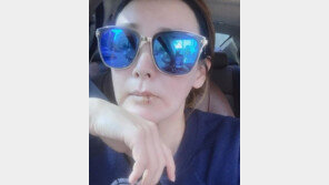 이상아, 입술 필러 부작용 “불법시술 절대 안 돼”