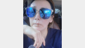 [내가 왜 떴게?] 너도 해볼래?…이상아, 입술필러