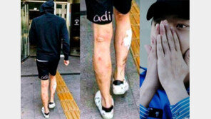 “박유천, 온몸 썩고 피딱지” 2년 前 황하나 SNS 글, ‘메스 버그’ 뒷받침?