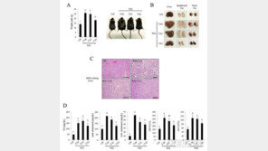 “감·도토리 떫은 맛 탄닌산, 지방간 억제 효과 있다”